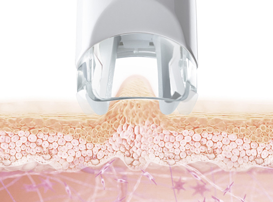 エンダモビリフトイメージ