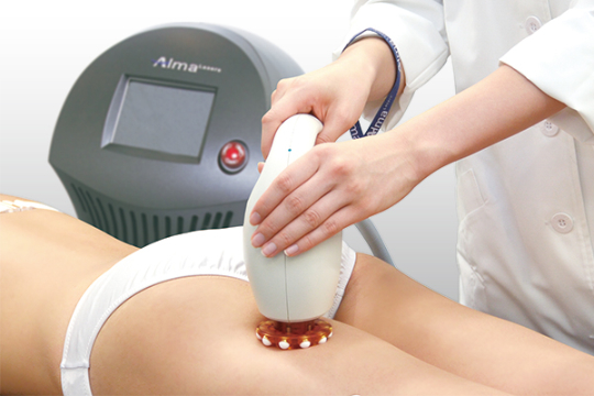 サーモトルネードイメージ2